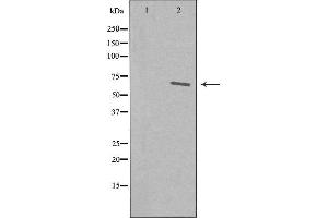 Image no. 2 for anti-IKAROS Family Zinc Finger 3 (Aiolos) (IKZF3) (Internal Region) antibody (ABIN6258240)