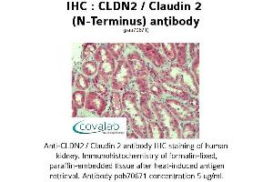 Image no. 2 for anti-Claudin 2 (CLDN2) (N-Term) antibody (ABIN2852368)