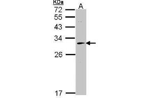 Image no. 3 for anti-Hydroxyacylglutathione Hydrolase (HAGH) (Center) antibody (ABIN2856165)