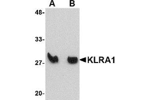 Image no. 1 for anti-Killer Cell Lectin-Like Receptor, Subfamily A, Member 1 (KLRA1) (Middle Region) antibody (ABIN1030976)