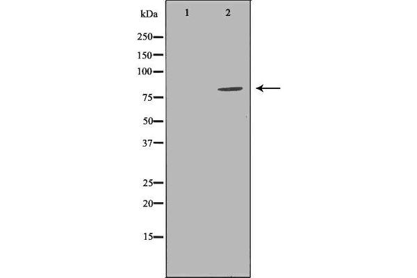 anti-Adrenergic, Beta, Receptor Kinase 1 (ADRBK1) (Internal Region) antibody