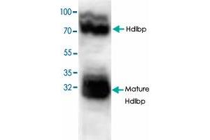 Image no. 1 for anti-High Density Lipoprotein Binding Protein (HDLBP) antibody (ABIN549292)