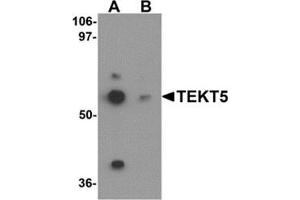 Image no. 1 for anti-Tektin 5 (TEKT5) (Center) antibody (ABIN783496)