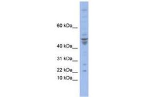 Image no. 1 for anti-Polymerase (DNA-Directed), epsilon 4 (p12 Subunit) (POLE4) (N-Term) antibody (ABIN6742852)