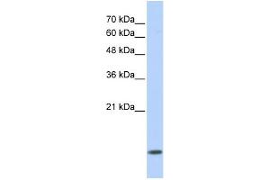 Image no. 1 for anti-Dynein, Light Chain, LC8-Type 1 (DYNLL1) (Middle Region) antibody (ABIN2784485)