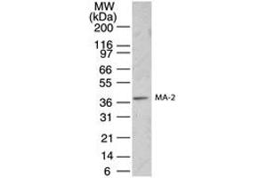 Image no. 1 for anti-Paraneoplastic Antigen MA2 (PNMA2) (AA 143-158) antibody (ABIN233120)