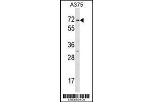 Image no. 1 for anti-Keratin 75 (KRT75) (AA 66-92), (N-Term) antibody (ABIN1539522)