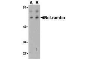 Image no. 2 for anti-BCL2-Like 13 (Apoptosis Facilitator) (BCL2L13) (Intermediate Domain) antibody (ABIN499433)