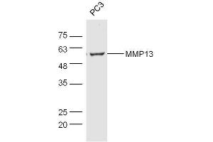 Image no. 5 for anti-Matrix Metallopeptidase 13 (Collagenase 3) (MMP13) (AA 201-300) antibody (ABIN670341)