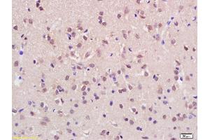 Image no. 1 for anti-Ash1 (Absent, Small, Or Homeotic)-like (ASH1L) (AA 1985-2060) antibody (ABIN1387873)