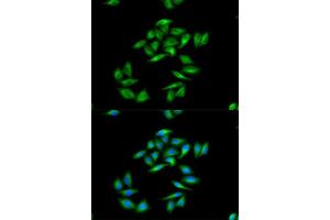 Image no. 3 for anti-Carnitine Palmitoyltransferase 1A (Liver) (CPT1A) antibody (ABIN6138976)