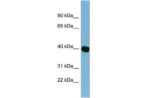 Image no. 1 for anti-Chromosome 14 Open Reading Frame 148 (C14orf148) (Middle Region) antibody (ABIN2785019)
