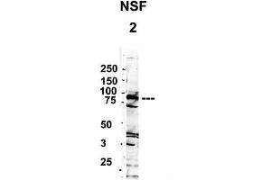 Image no. 5 for anti-Y Box Binding Protein 1 (YBX1) (Middle Region) antibody (ABIN2775773)