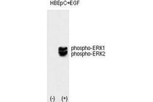 Image no. 3 for anti-Mitogen-Activated Protein Kinase 1/3 (MAPK1/3) (pThr202), (pTyr204) antibody (ABIN3031824)