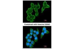ICC/IF Image Immunofluorescence analysis of methanol-fixed A431, using Cystatin S, antibody at 1:200 dilution.