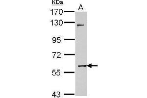 Image no. 2 for anti-Matrix Metallopeptidase 8 (Neutrophil Collagenase) (MMP8) (Center) antibody (ABIN2856104)