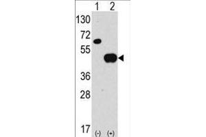 ATG4B 抗体  (N-Term)