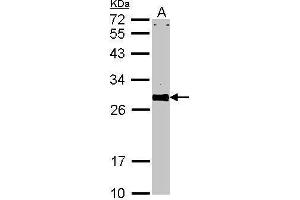 Image no. 1 for anti-VAMP (Vesicle-Associated Membrane Protein)-Associated Protein A, 33kDa (VAPA) (Center) antibody (ABIN2856826)
