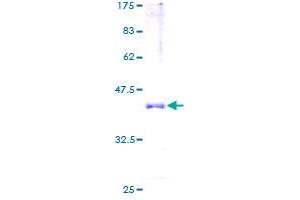 Image no. 1 for Hemoglobin, alpha 2 (HBa2) (AA 1-142) protein (GST tag) (ABIN1306385)