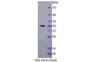 Image no. 1 for Cyclin-Dependent Kinase Inhibitor 1B (p27, Kip1) (CDKN1B) (AA 2-197) protein (His tag) (ABIN6239468)