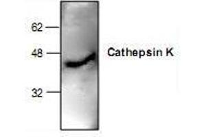 Image no. 1 for anti-Cathepsin K (CTSK) antibody (ABIN223282)