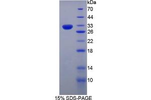 Image no. 1 for CASP8 and FADD-Like Apoptosis Regulator (CFLAR) (AA 43-281) protein (T7 tag,His tag) (ABIN6238308)