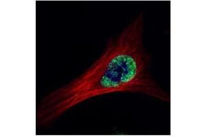 Image no. 5 for anti-V-Ets Erythroblastosis Virus E26 Oncogene Homolog 2 (ETS2) (Center) antibody (ABIN2855845)