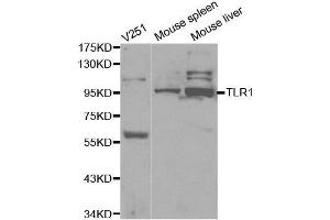 Image no. 1 for anti-Toll-Like Receptor 1 (TLR1) antibody (ABIN3023655)