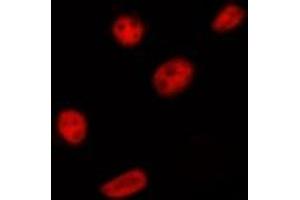 Image no. 1 for anti-PRP18 Pre-mRNA Processing Factor 18 (PRPF18) antibody (ABIN6259055)