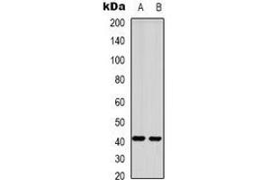 Image no. 2 for anti-G Protein-Coupled Receptor 87 (GPR87) antibody (ABIN2957590)