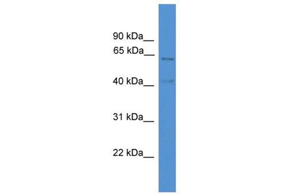 anti-Acyl-CoA Dehydrogenase, Very Long Chain (ACADVL) (C-Term) antibody