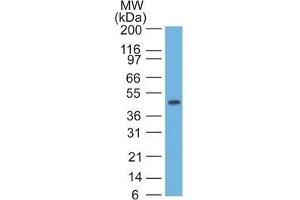 Image no. 1 for anti-Keratin 17 (KRT17) antibody (ABIN6939923)
