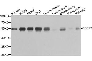 Image no. 2 for anti-Retinoblastoma Binding Protein 7 (RBBP7) antibody (ABIN6570817)