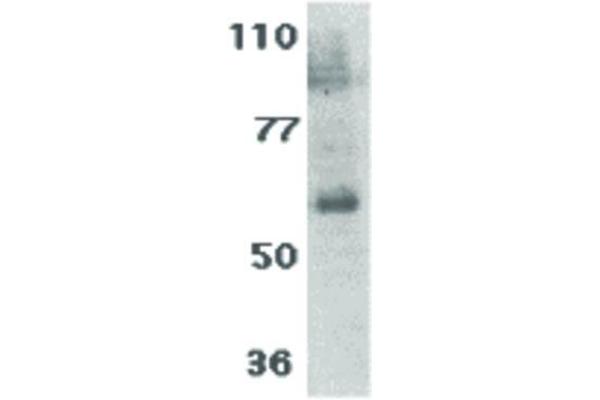 IL21 Receptor Antikörper
