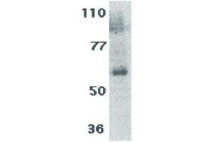 Image no. 3 for anti-Interleukin 21 Receptor (IL21R) antibody (ABIN6656222)