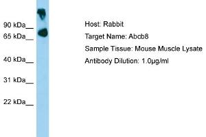 Image no. 1 for anti-ATP-Binding Cassette, Sub-Family B (MDR/TAP), Member 8 (ABCB8) (Middle Region) antibody (ABIN2781517)