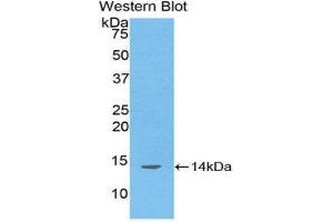 Image no. 1 for anti-D-Aspartate Oxidase (DDO) (AA 117-199) antibody (ABIN1176733)