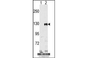 Western Blotting (WB) image for anti-EPH Receptor B1 (EPHB1) antibody (ABIN2158721)