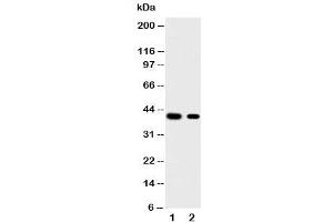 Image no. 2 for anti-Kruppel-Like Factor 5 (Intestinal) (KLF5) (Middle Region) antibody (ABIN3031574)