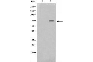 Image no. 4 for anti-Interleukin 2 Receptor, beta (IL2RB) (Internal Region) antibody (ABIN6262526)