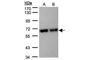 Image no. 1 for anti-Stress-Induced-phosphoprotein 1 (STIP1) (Center) antibody (ABIN2855549)