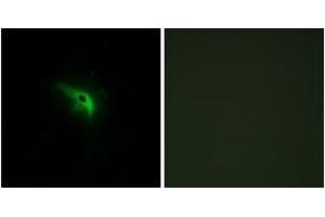 Image no. 2 for anti-P53-Regulated Apoptosis-Inducing Protein 1 (TP53AIP1) (AA 75-124) antibody (ABIN1534492)