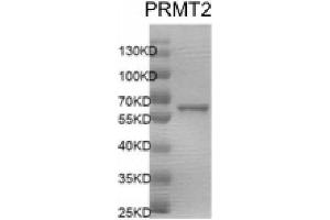 Protein Arginine Methyltransferase 2 (PRMT2) protein (DYKDDDDK Tag)