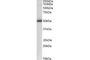 Image no. 2 for anti-Acid Phosphatase, Prostate (ACPP) (Internal Region) antibody (ABIN570986)
