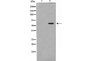Image no. 3 for anti-Proto-oncogene tyrosine-protein kinase Src (Src) (pTyr530) antibody (ABIN6256758)