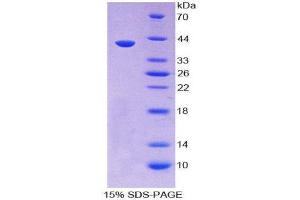 Image no. 1 for Secretoglobin, Family 3A, Member 1 (SCGB3A1) (AA 21-104) protein (His tag,GST tag) (ABIN2123584)