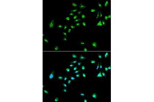 Image no. 2 for anti-V-Raf-1 Murine Leukemia Viral Oncogene Homolog 1 (RAF1) (C-Term) antibody (ABIN3020713)
