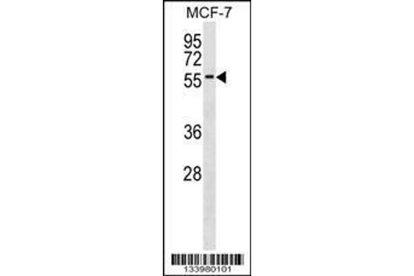 anti-Zinc Finger Protein 787 (ZNF787) (AA 1-30), (N-Term) antibody