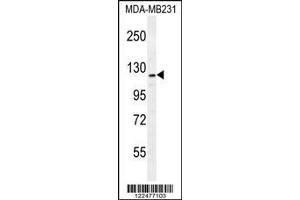 anti-ADAM Metallopeptidase with thrombospondin Type 1 Motif, 18 (ADAMTS18) (AA 1066-1095), (C-Term) antibody