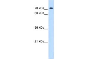 Image no. 1 for anti-Solute Carrier Family 5 (Sodium/inositol Cotransporter), Member 11 (SLC5A11) antibody (ABIN2462773)